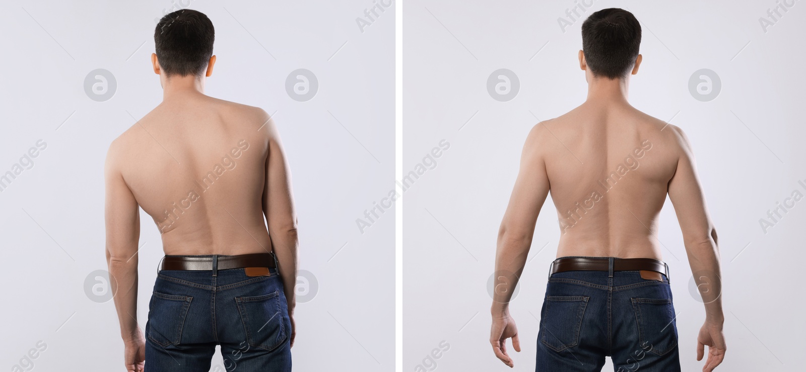 Image of Before and after collage showing man with good and bad posture against white background