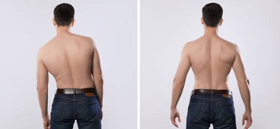 Image of Before and after collage showing man with good and bad posture against white background