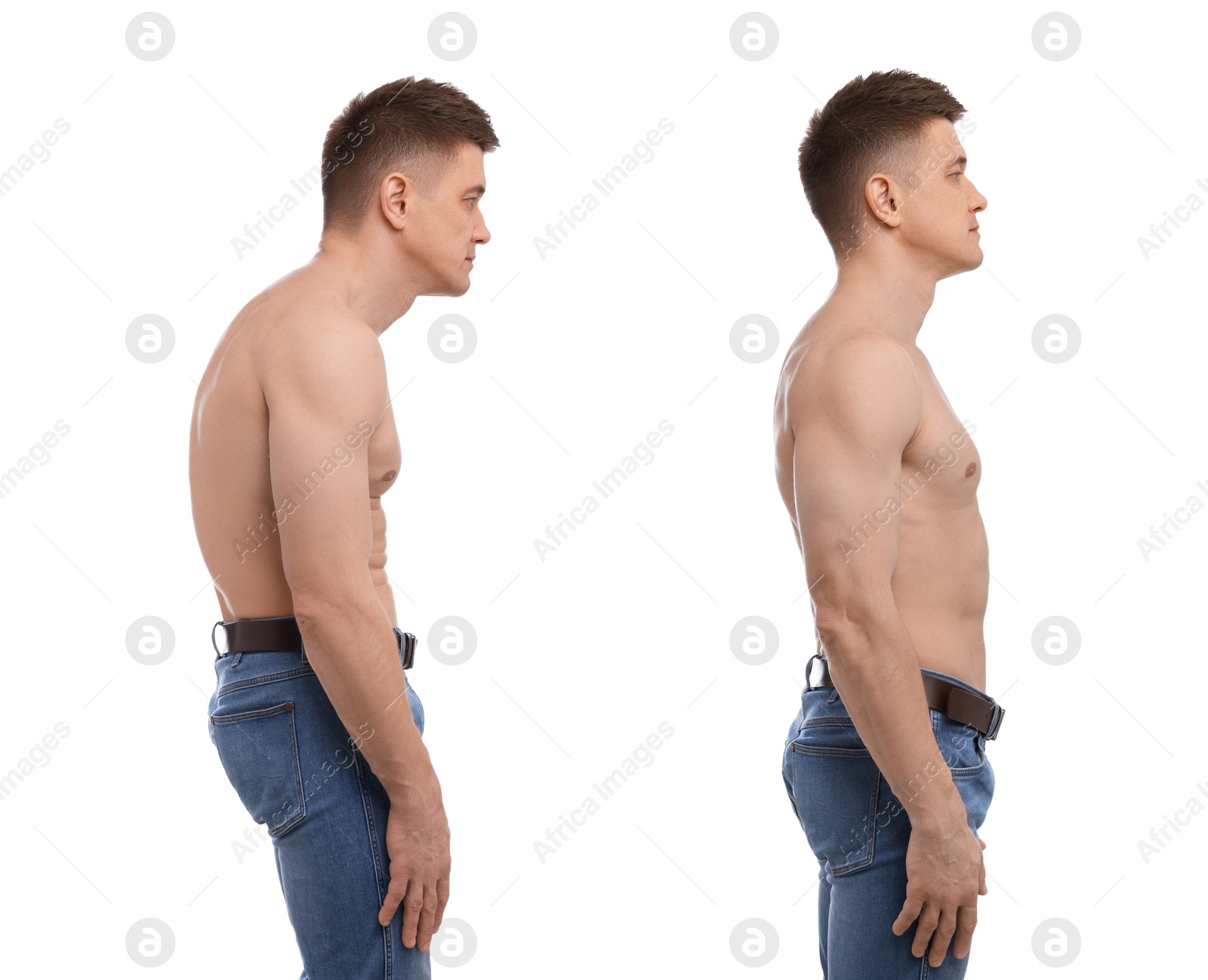 Before and after collage showing man with good and bad posture against white background Image of Before and after collage showing man with good and bad posture against white background