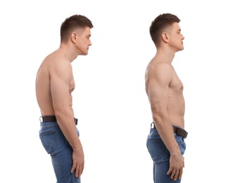 Image of Before and after collage showing man with good and bad posture against white background