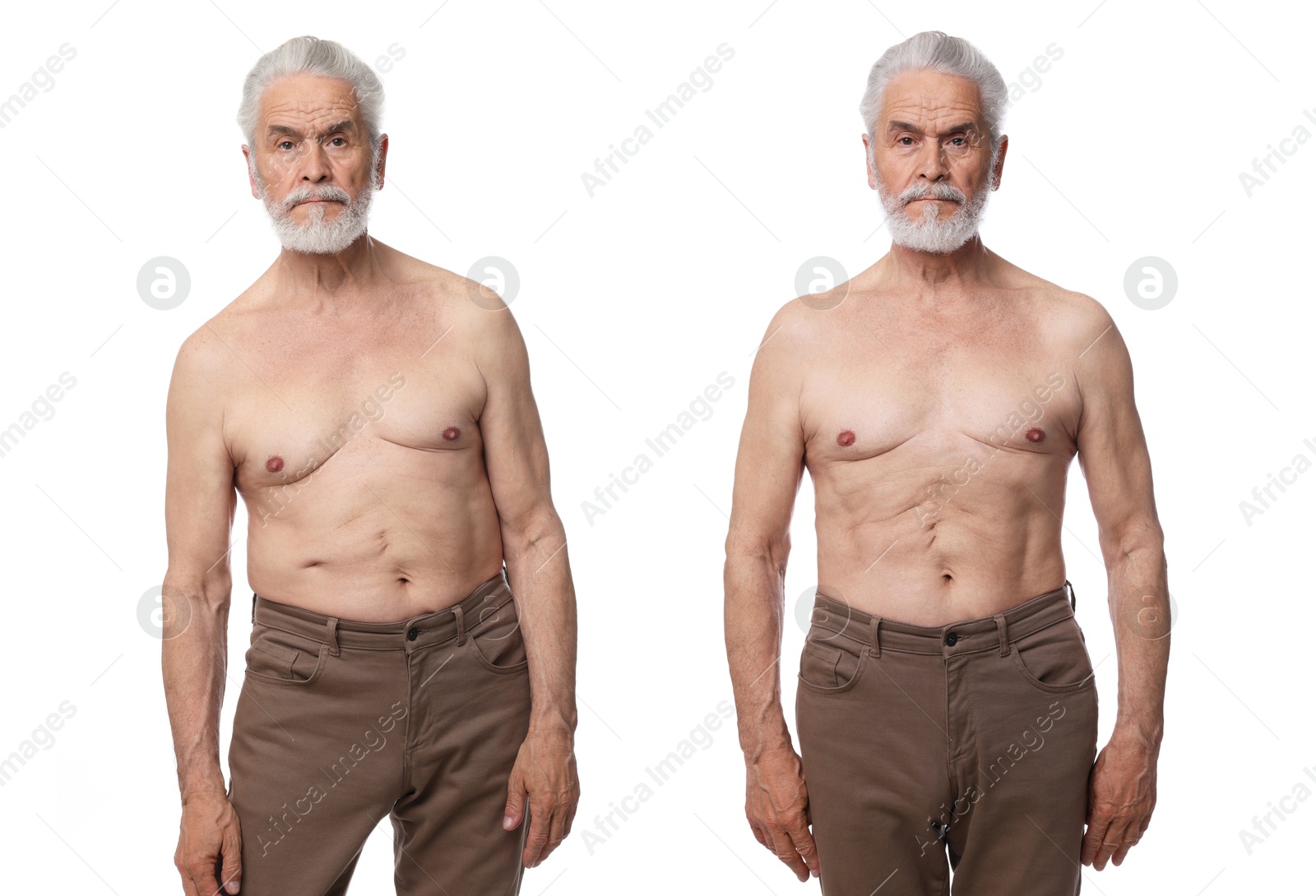 Image of Before and after collage showing man with good and bad posture against white background