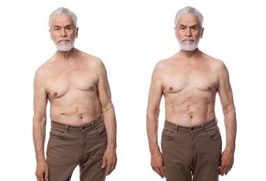 Image of Before and after collage showing man with good and bad posture against white background
