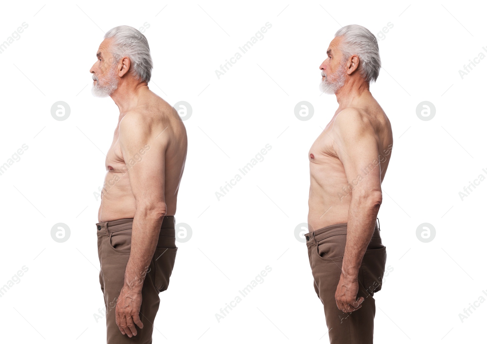 Image of Before and after collage showing man with good and bad posture against white background