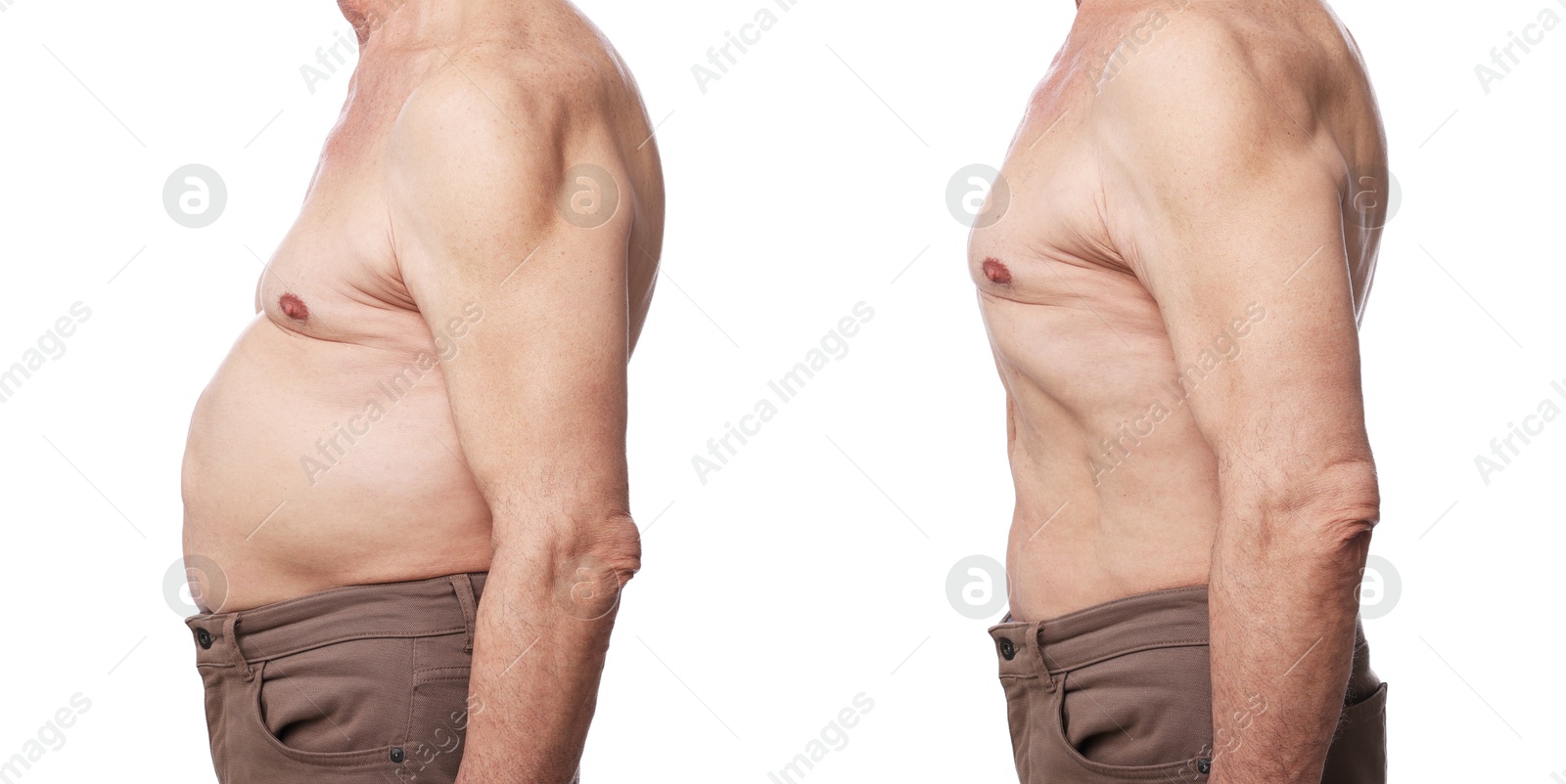Before and after collage showing man with good and bad posture against white background, closeup Image of Before and after collage showing man with good and bad posture against white background, closeup
