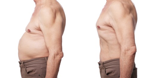 Image of Before and after collage showing man with good and bad posture against white background, closeup