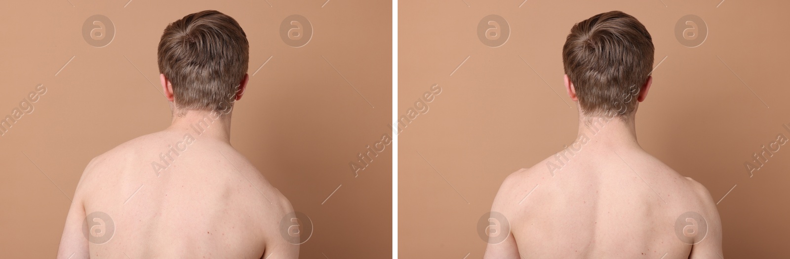 Image of Before and after collage showing man with good and bad posture against pale brown background