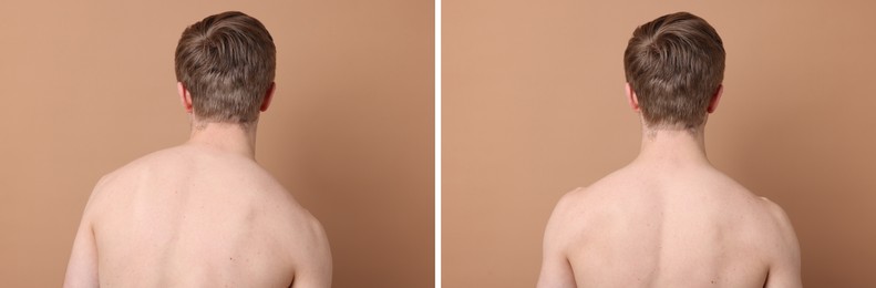 Image of Before and after collage showing man with good and bad posture against pale brown background