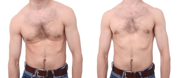 Image of Before and after collage showing man with good and bad posture against white background, closeup