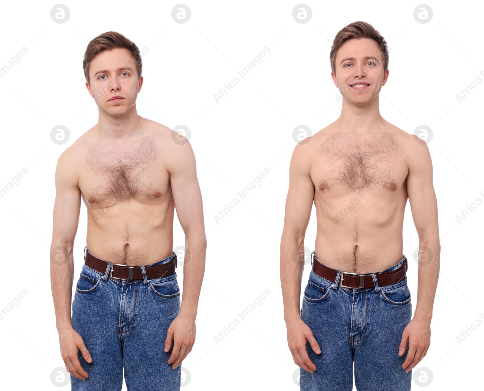 Before and after collage showing man with good and bad posture against white background Image of Before and after collage showing man with good and bad posture against white background