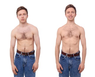 Image of Before and after collage showing man with good and bad posture against white background