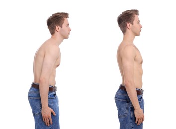 Image of Before and after collage showing man with good and bad posture against white background