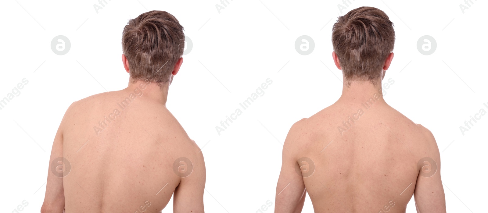 Before and after collage showing man with good and bad posture against white background Image of Before and after collage showing man with good and bad posture against white background