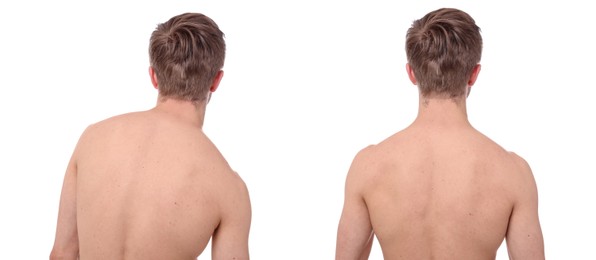 Image of Before and after collage showing man with good and bad posture against white background