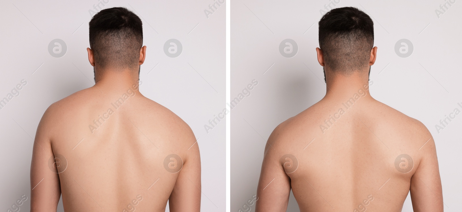 Before and after collage showing man with good and bad posture against white background Image of Before and after collage showing man with good and bad posture against white background