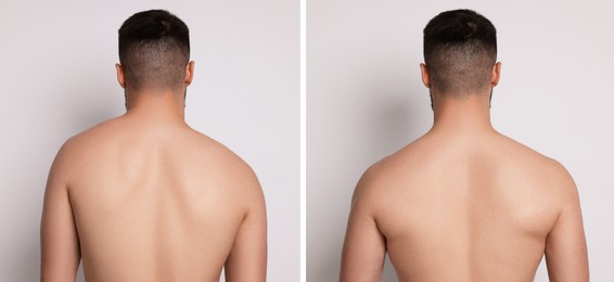 Image of Before and after collage showing man with good and bad posture against white background