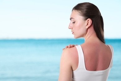 Image of Woman with sunburned skin against sea, back view