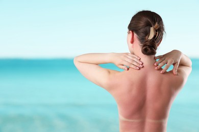 Image of Woman with sunburned skin against sea, back view