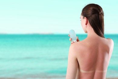 Image of Woman with sunburned skin holding smoothing cream against sea, back view
