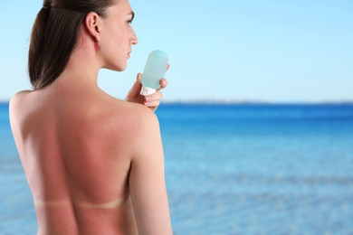 Image of Woman with sunburned skin holding smoothing cream against sea, back view