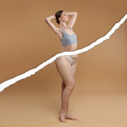 Image of Slim woman and torn photo of her previous oversize body shape. Collage on dark beige background. Liposuction, weight loss, healthy lifestyle