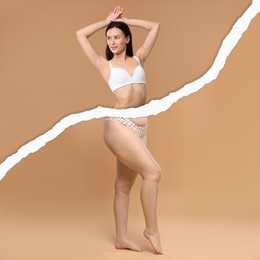 Image of Slim woman and torn photo of her previous oversize body shape. Collage on dark beige background. Liposuction, weight loss, healthy lifestyle
