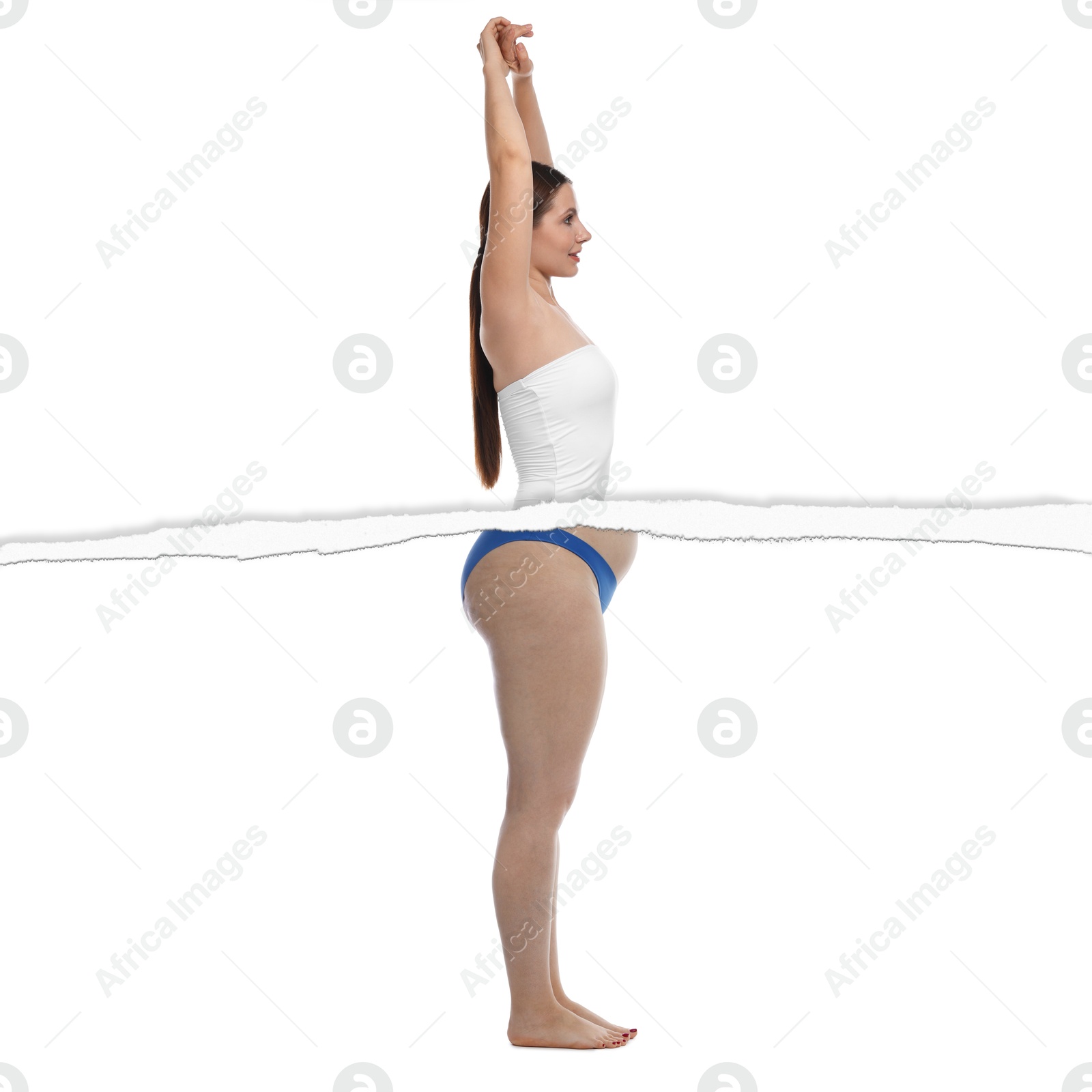 Slim woman and torn photo of her previous oversize body shape. Collage on white background. Liposuction, weight loss, healthy lifestyle Image of Slim woman and torn photo of her previous oversize body shape. Collage on white background. Liposuction, weight loss, healthy lifestyle