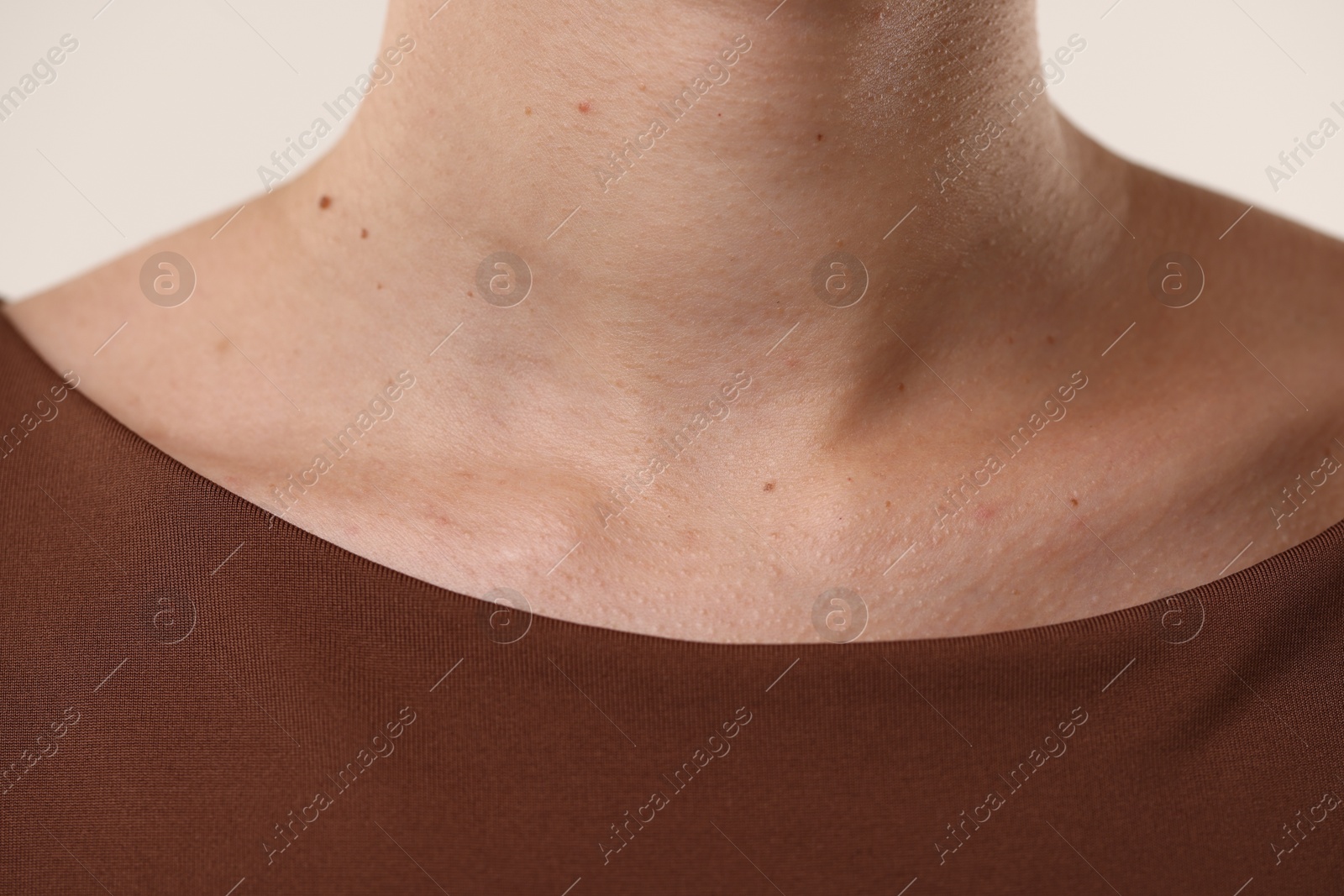 Photo of Woman with healthy skin on light background, closeup