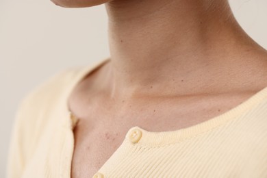 Photo of Closeup view of woman on light background