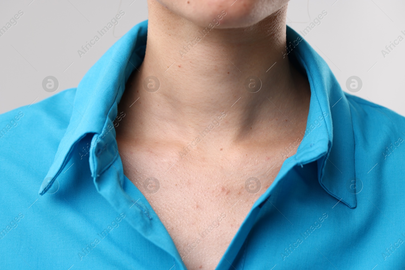 Photo of Closeup view of woman on light grey background