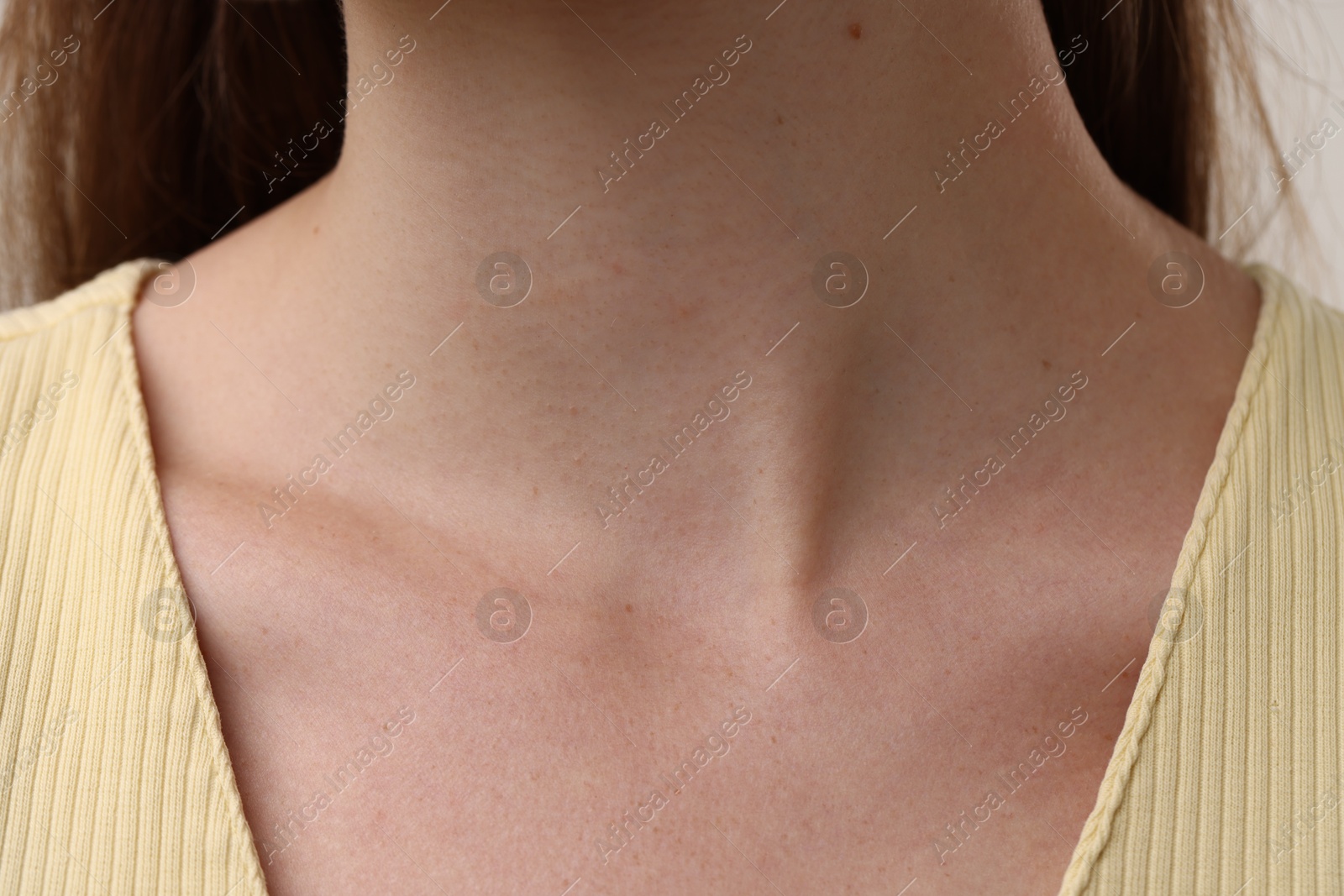 Photo of Closeup view of woman with healthy skin