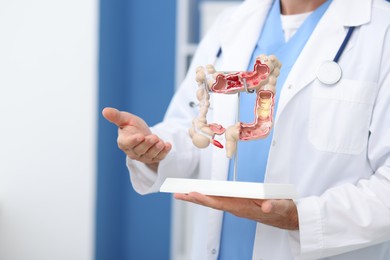 Photo of Gastroenterologist showing model of large intestine in clinic, closeup