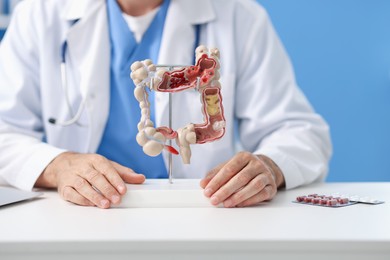 Photo of Gastroenterologist showing model of large intestine at white table in clinic, closeup