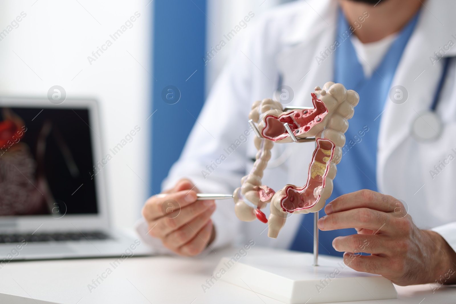 Photo of Gastroenterologist with model of large intestine at white table in clinic, closeup