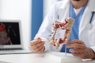 Photo of Gastroenterologist with model of large intestine at white table in clinic, closeup