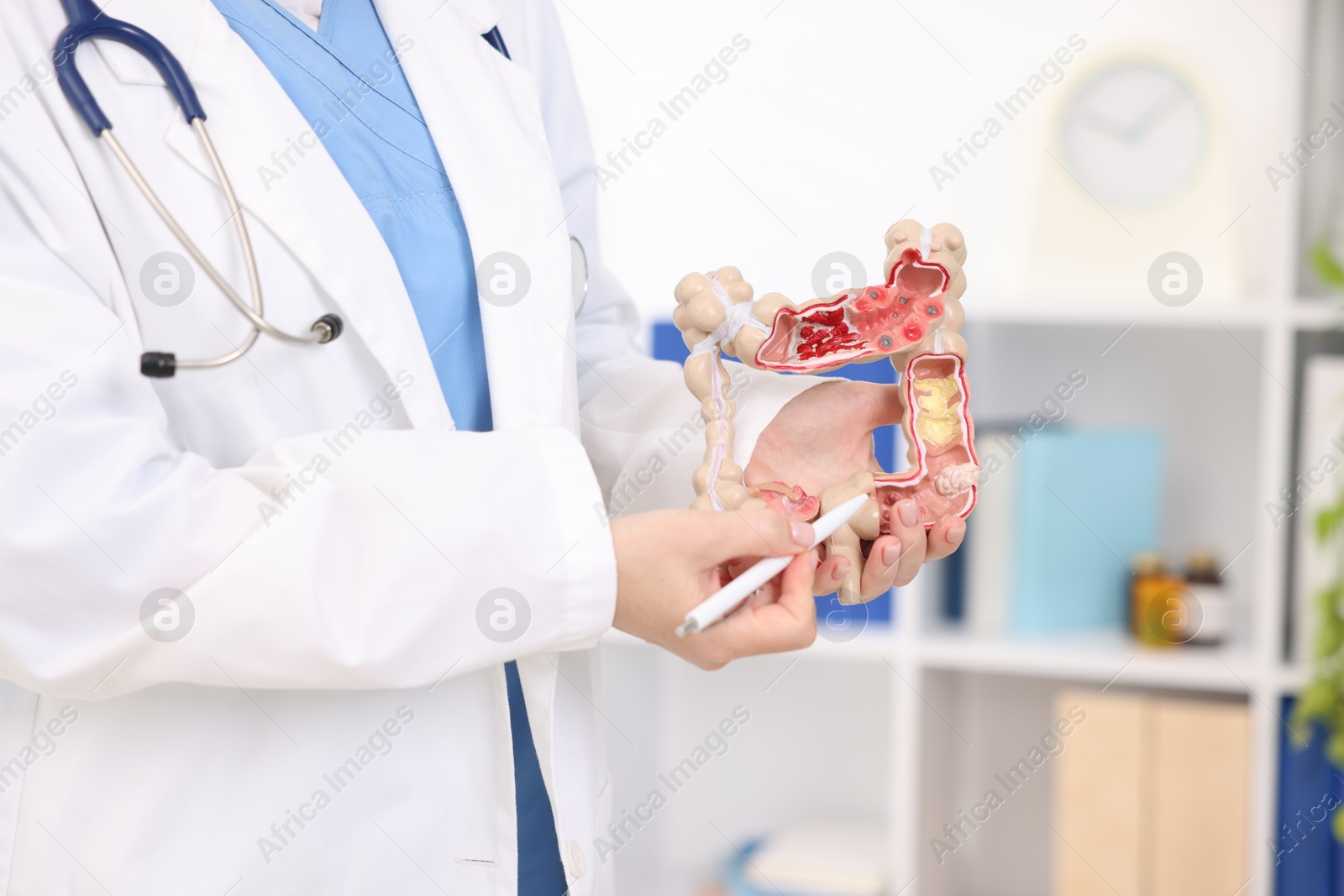 Photo of Gastroenterologist showing model of large intestine in clinic, closeup