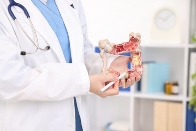 Photo of Gastroenterologist showing model of large intestine in clinic, closeup