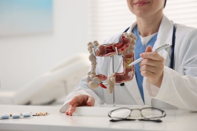 Photo of Gastroenterologist showing model of large intestine at white table in clinic, closeup. Space for text