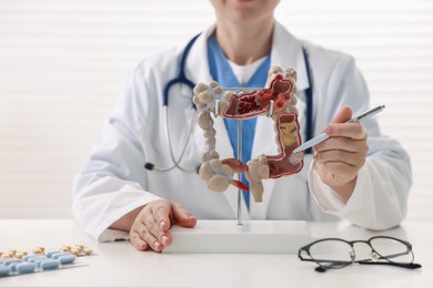 Photo of Gastroenterologist showing model of large intestine at white table in clinic, closeup