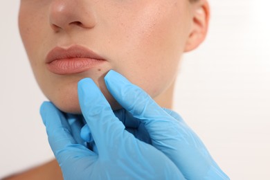 Photo of Doctor examining young woman's mole on white background, closeup
