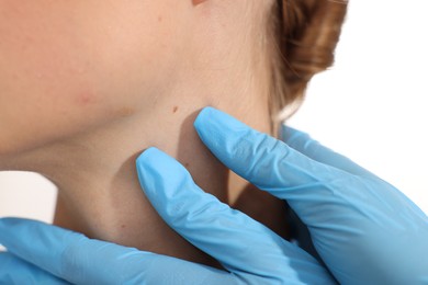 Photo of Doctor examining young woman's mole on white background, closeup