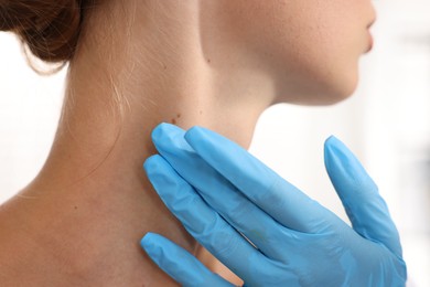 Photo of Doctor examining young woman's mole on white background, closeup