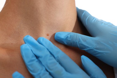 Photo of Doctor examining young woman's mole on white background, closeup