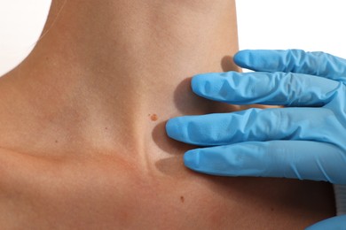 Photo of Doctor examining young woman's mole on white background, closeup
