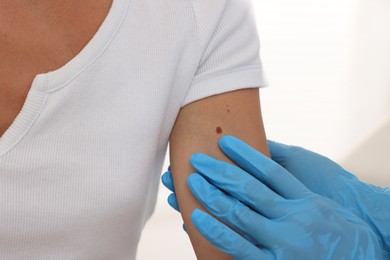 Photo of Doctor examining young woman's mole on white background, closeup