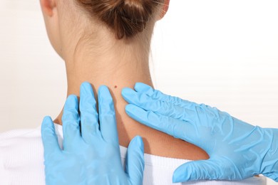 Photo of Doctor examining young woman's mole on white background, closeup