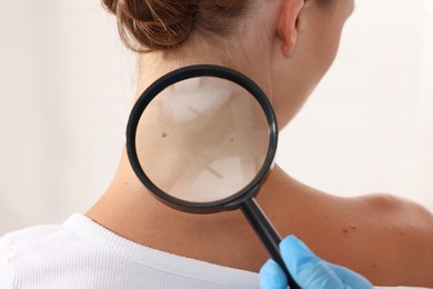 Photo of Doctor examining young woman's mole with magnifying glass on white background, closeup