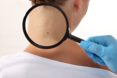 Photo of Doctor examining young woman's mole with magnifying glass on white background, closeup