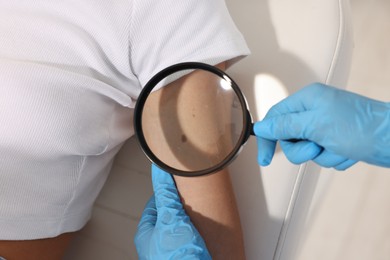 Photo of Doctor examining young woman's mole with magnifying glass in hospital, closeup