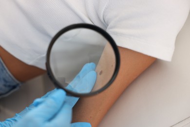 Photo of Doctor examining young woman's mole with magnifying glass in hospital, closeup