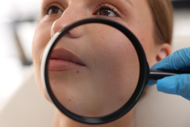 Photo of Doctor examining young woman's mole with magnifying glass in hospital, closeup